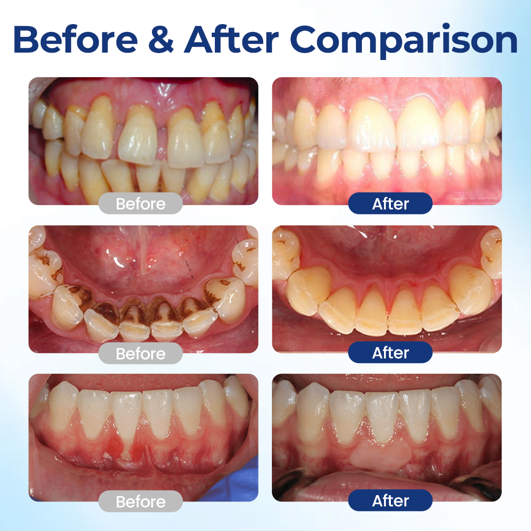 🔥Alcuras® BeeTakt Oral Repair Solution