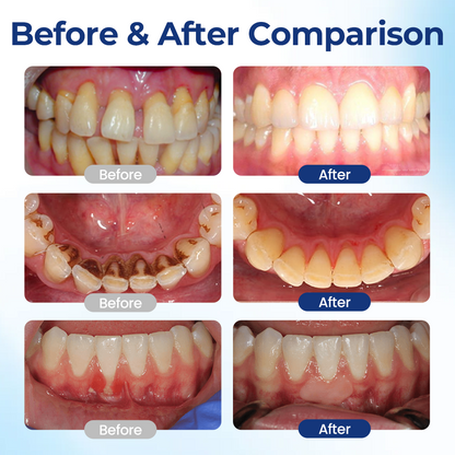 🔥Alcuras® BeeTakt Oral Repair Solution